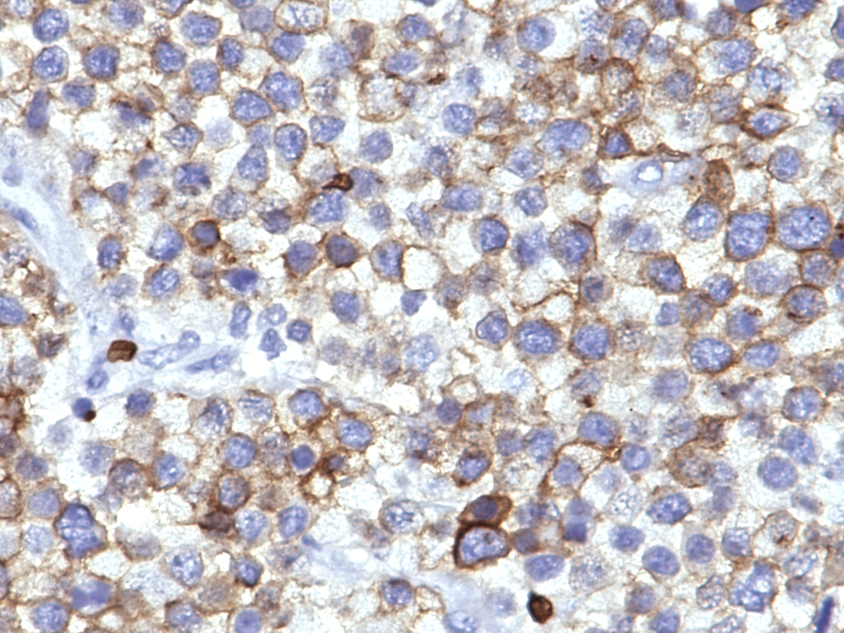 Glycophorin C immunohistochemistry